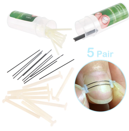 Ingrown Toenail Corrector Tools  Effektiv Korrigering av Invxta Tnaglar
